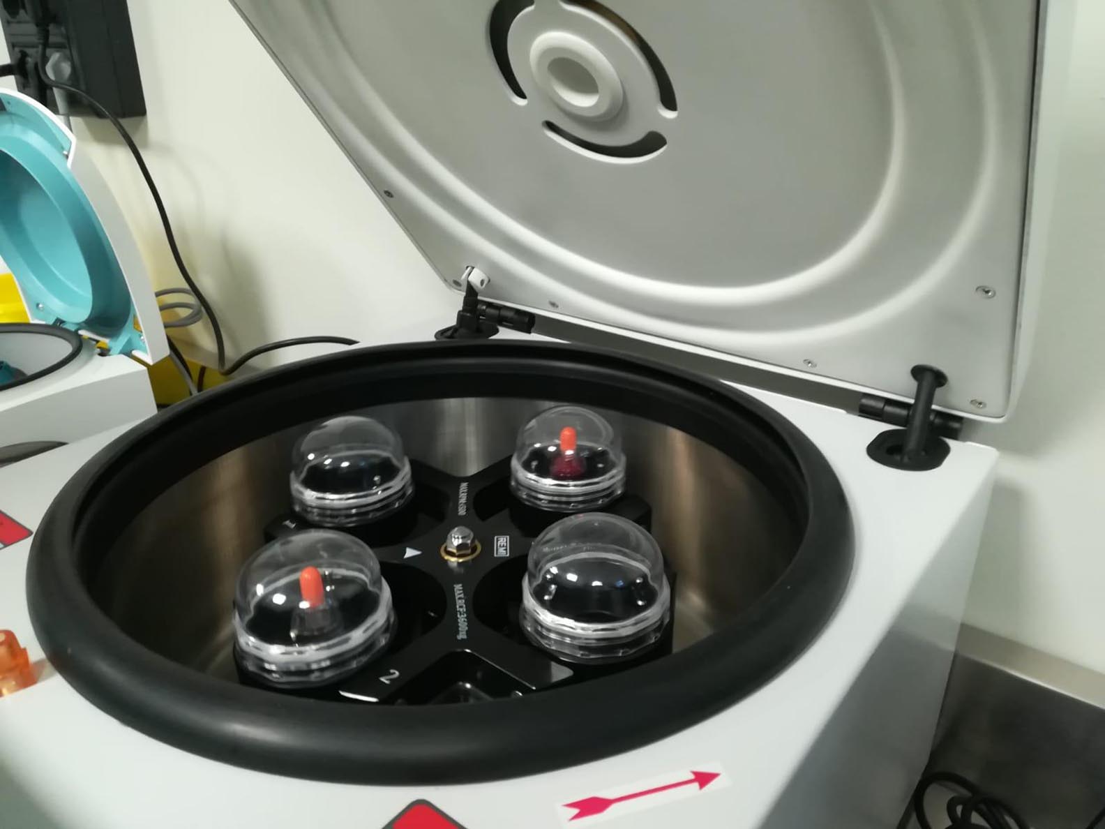 prp centrifuga